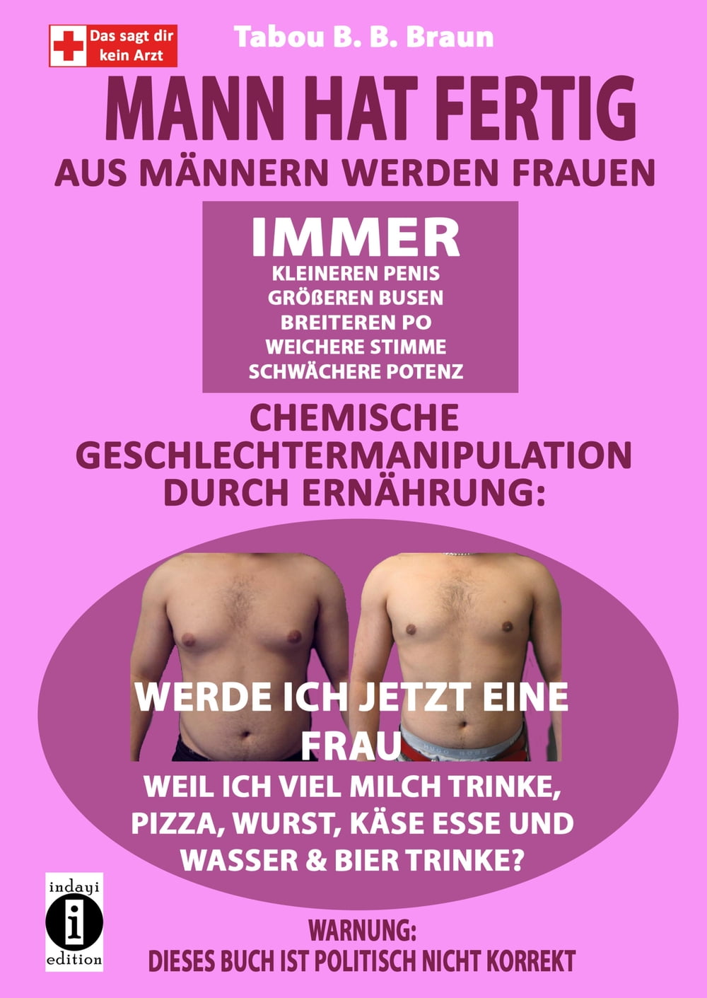 ibs