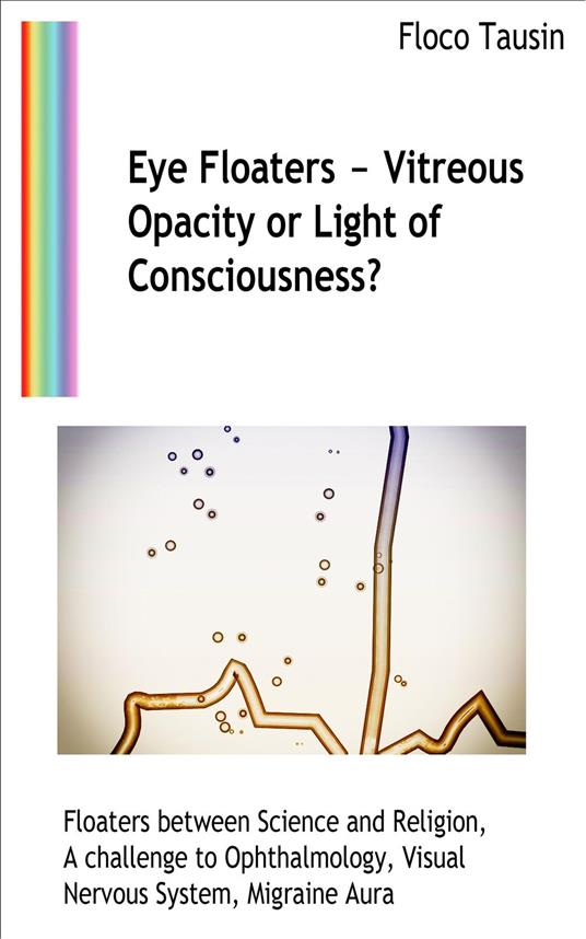 Eye Floaters - Vitreous Opacity or Light of Consciousness?